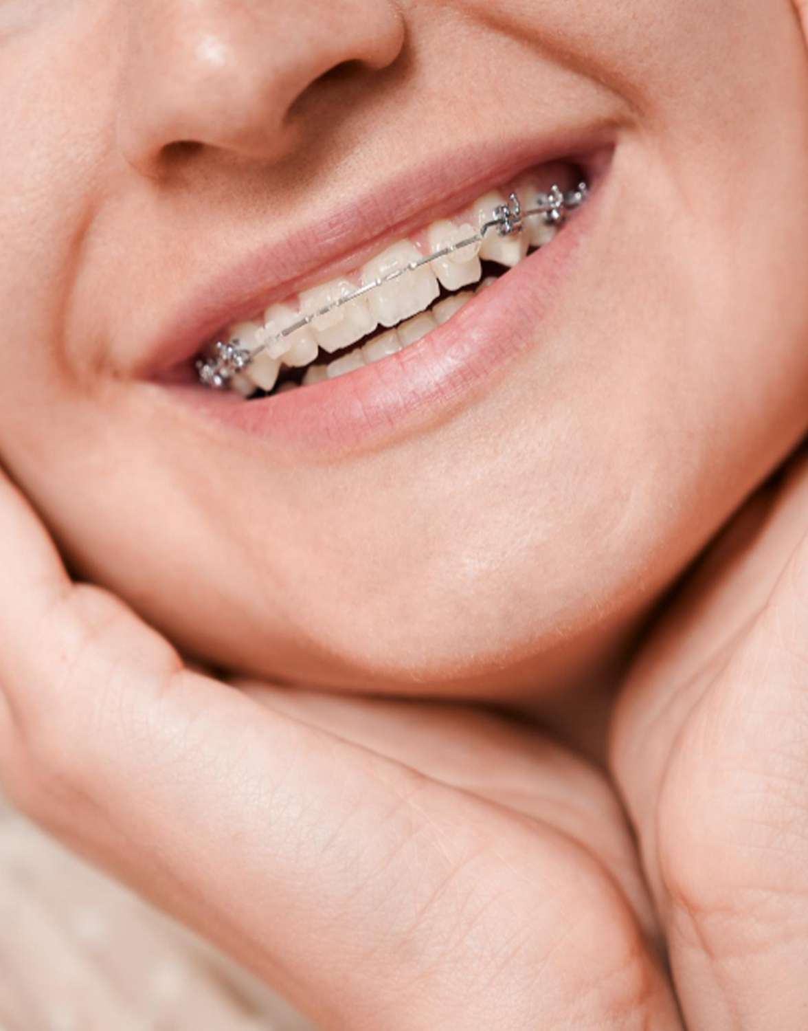 Victory traditional metal brackets
