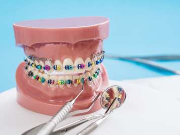 Orthodontic treatment options