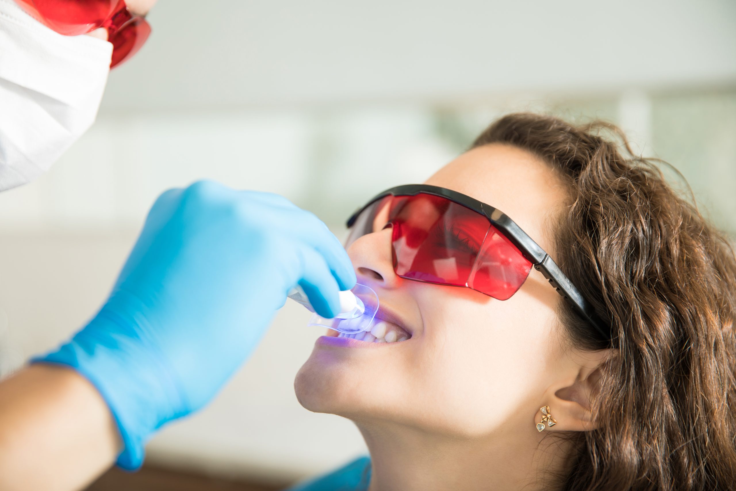 Discoloured Teeth Whitening in Turramurra